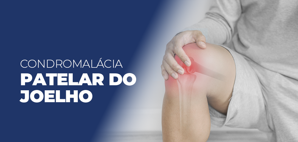 condromalacia-patelar-do-joelho