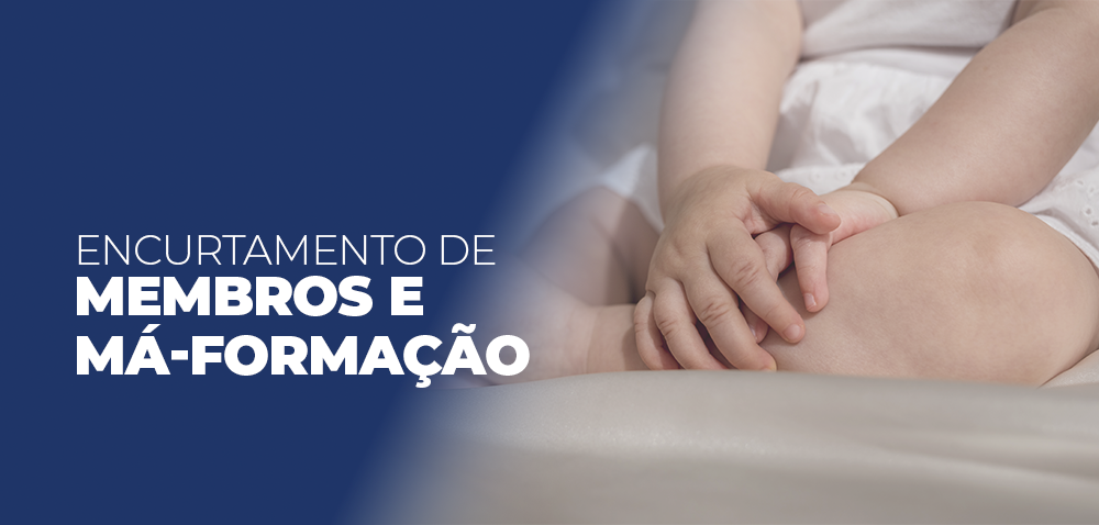 encurtamento-de-membros-e-ma-formacao