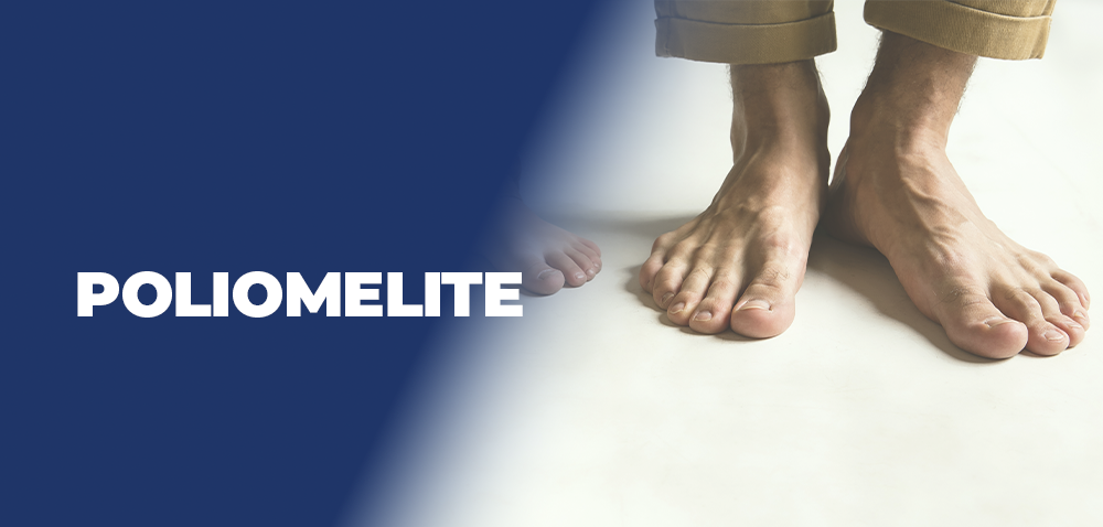 poliomelite